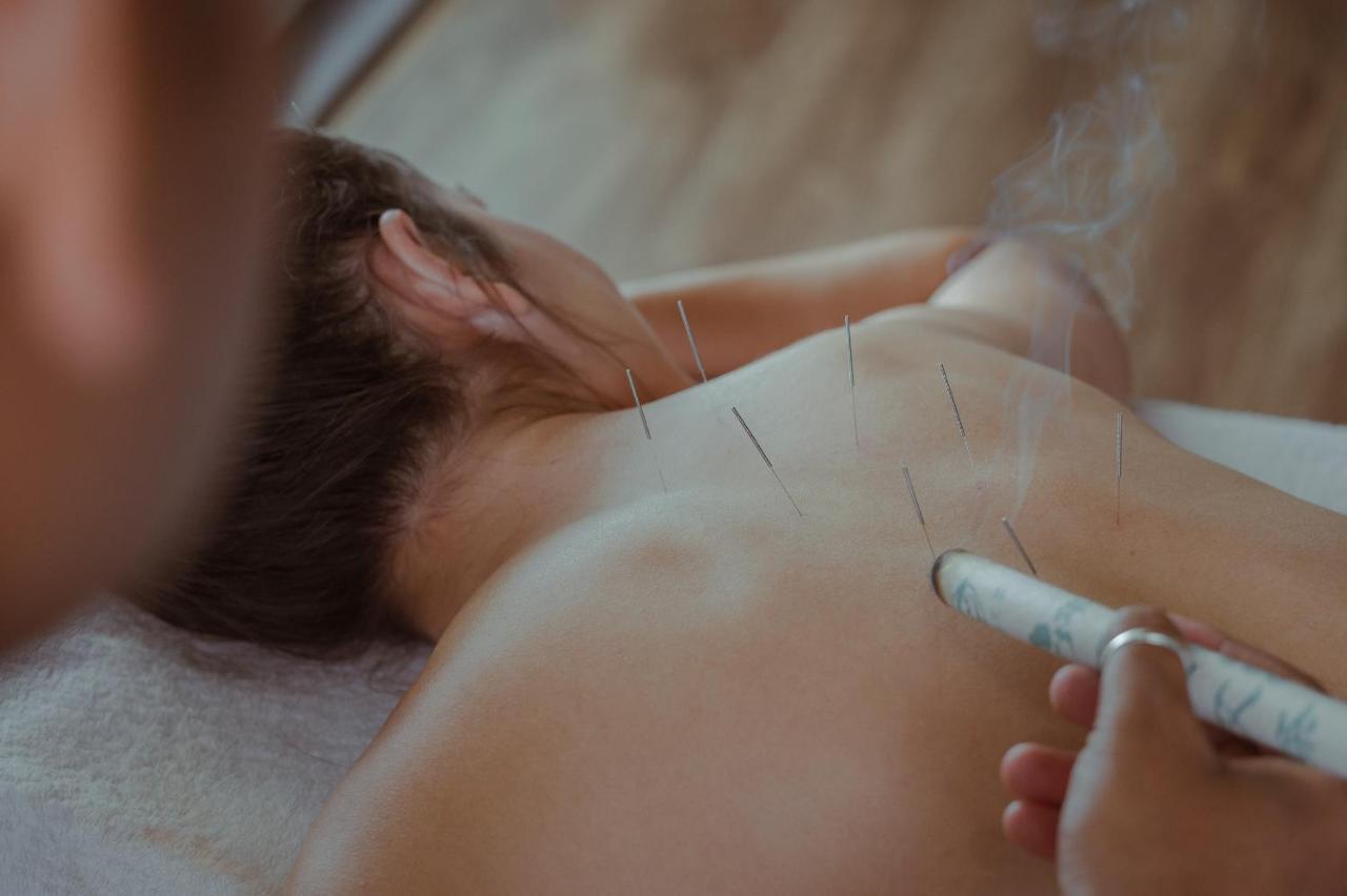 Amatara Welleisure Resort Cape Panwa Bagian luar foto Acupuncture